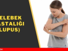 Kelebek hastal! Lupus (Kelebek hastal) nedir? SLE nedir, belirtileri nelerdir?