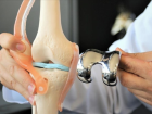 Kire�lenme nedir, neden olur? Belirtileri ve tedavi y�ntemleri