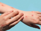 K�zam�k vakalar�n�n en yayg�n oldu�u 5 il! Birinci s�rada �stanbul var