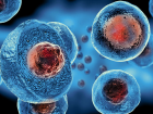 Kök Hücre Tedavisi Hangi Hastalıklara Fayda Sağlıyor?