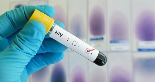Kk Hcre Tedavisi Sonras HIV Virsl Hastada yileme Grld