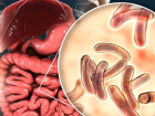 Kolera nedir? Kolera hastal��� belirtileri neler? Kolera salg�n� tedavisi