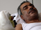 Kopan parmaklar�n� po�etle hastaneye g�t�rd�, 12 saatte dikildi