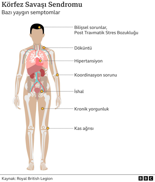 Krfez Sava'na giden askerlerin gizemli hastalnn nedeni sarin gaz kt