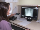 Koronal� hastalar�n akci�er r�ntgenleri korkuttu