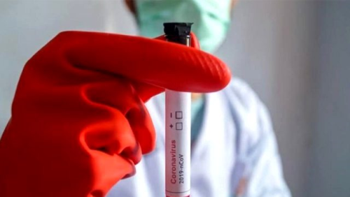 Koronavirs testi sonular nasl renilir? Kronavirs test sonular sorgulama!