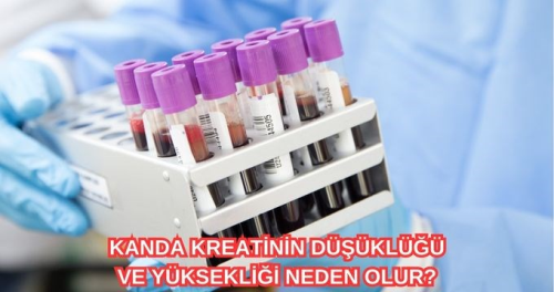 Kreatinin nedir? Kanda kreatinin dkl ve ykseklii neden olur?