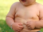 Küçük Yaşta Obez Olan Adamın Hikayesi
