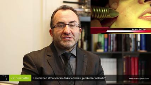 Lazerle Ben Alma Sonras Dikkat Edilmesi Gerekenler Nelerdir? - Op. Dr. Nuri Battal