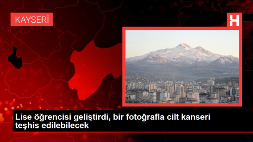 Lise rencisi gelitirdi, bir fotorafla cilt kanseri tehis edilebilecek