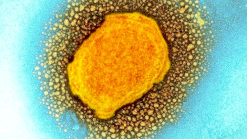 Maymun �i�e�i vir�s�: �ngiltere'de vaka say�s� 20'ye y�kseldi, h�k�met a�� sto�unu art�r�yor