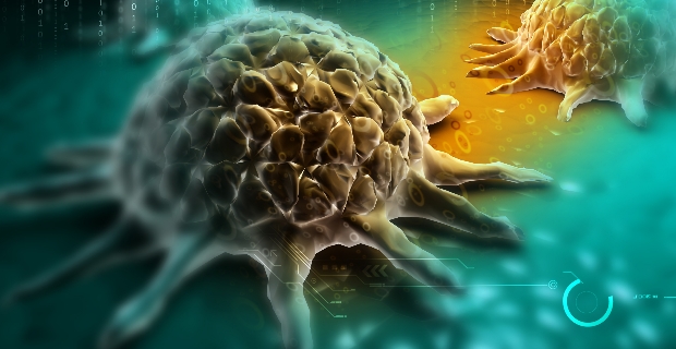 Nadir Kanser Trne Yakalanma Nedeni Bulundu