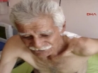 Omuzundaki 2 Kiloluk Ya� Bezesini 72 Y�l Sonra Ald�rd�