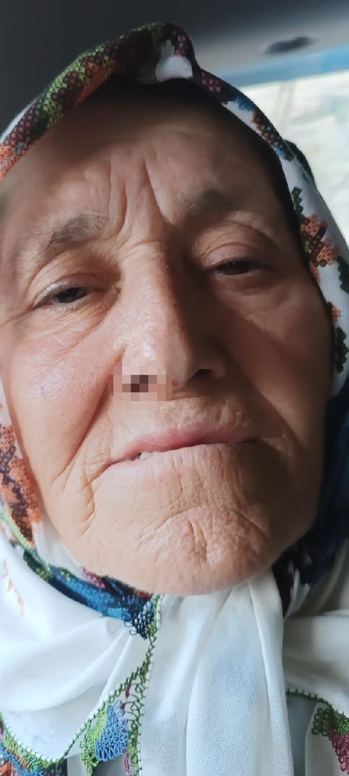 Ordu'da ii bo fndk tartmas: Kadn darbedildi