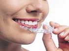 Ortodontik Problemlerin Sebepleri Nelerdir?