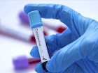 PCR testi nedir? PCR testi nas�l yap�l�r? PCR testi ba����kl�k oran� sonucu ka�?