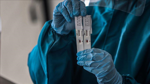 PCR testi zorunlu mu? Koronavirs testi yapmak artk mecburi deil mi?