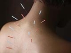 Pediatrik ve Menapozda Akupunktur