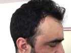 Randevusuna Zaman�nda Gelmeyen Hasta Di� Hekimini D�vd�