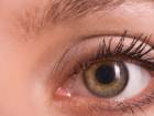 Retina H�cresi Naklinde �mit Verici Bulgu