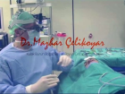 Rinoplastiye Ba�lang�� - Dr.rinoplasti - Op. Dr. Mazhar �elikoyar