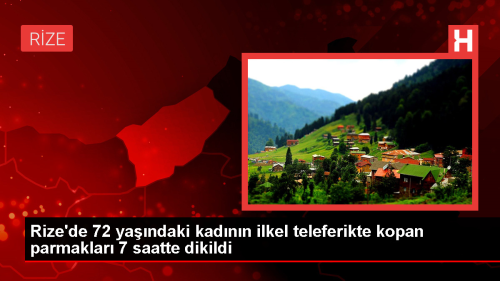 Rize'de ilkel teleferik kazas: 72 yandaki kadnn kopan 4 parma dikildi