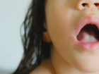 Sa�l�k Bakanl���'ndan Strep-A enfeksiyonunda 