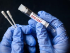 Sa�l�k ocaklar�nda PCR testi yap�l�yor mu? Coronavirus testi nerede yap�l�r?
