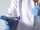 Sağlık Bakanlığı, online koronavirüs testi imkanı tanıyan siteyi devreye soktu