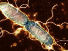 Salmonella nedir, nasl yaylyor, bakteri riski olan gdalar hangileri?