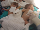 Şanlıurfa'da Siyam İkizleri Başarılı Bir Ameliyatla Birbirinden Ayrıldı