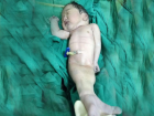 Sebebi �ok Ac�! Deniz K�z� Gibi Do�du, Do�umdan D�rt Saat Sonra Hayat�n� Kaybetti