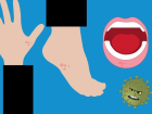 Sedef hastal nedir? Sedef hastal belirtileri nelerdir?