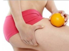 Sel�litlerden Kurtulmak ��in 20 �neri