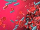 Sepsis in Ortak Eylem ars