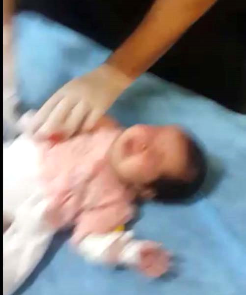 Serumu karmak steyen Hemir, Makasla 1,5 Aylk Bebein Parman Kesti