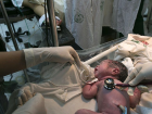 Sezeryan�n ard�ndan normal do�um 'anne ve bebek i�in riskleri y�kseltiyor'