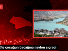 Siirt'te �ocu�un baca��na naylon s��rad�
