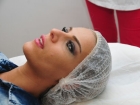 Simge ye �r�mcek a�� tekni�i ile ameliyats�z estetik