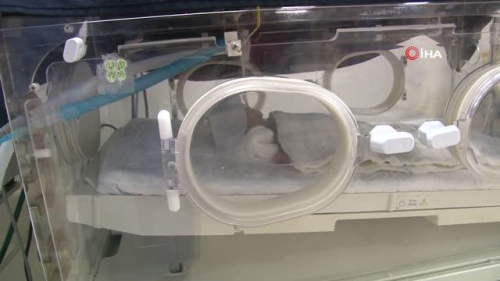 rnak'tan getirilen 25 haftalk 775 gramlk bebein tedavisi sryor