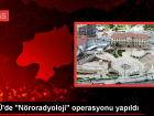 Sivas Cumhuriyet �niversitesinde N�roradyoloji Alan�nda Ba�ar�l� Bir Operasyon Ger�ekle�tirildi