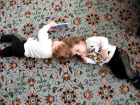 Siyam ikizleri, ba�ar�l� ameliyat�n ard�ndan T�rkiye'ye d�necek