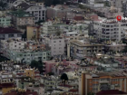 Siyam ikizleri yar�n T�rkiye'ye d�n�yor