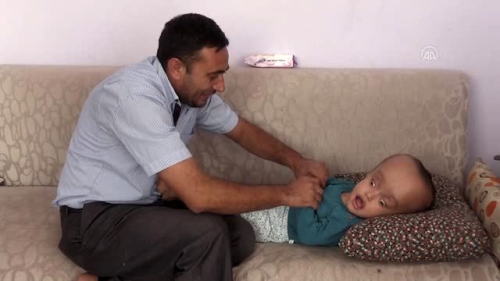 Son dakika... Hidransefali hastas Sercan'n sal iyiye gidiyor