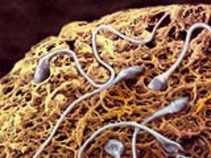 Sperm Alerjisi Nasl Oluur?