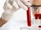 Talasemide D�zenli Demir Ba�lay�c� �la� Kullan�m� �nemli