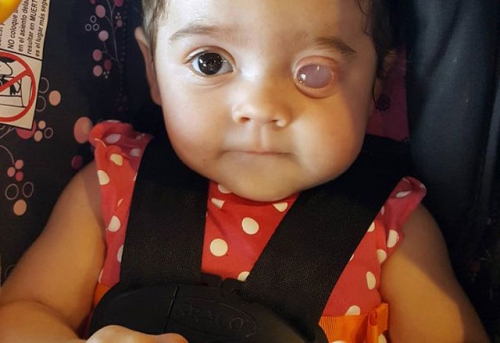 Tek Gözü Olmayan Bebek: Izabella Myers