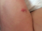 T�p D�nyas�n�n Hastal���na �are Bulamad��� Seyfi Bebe�in Annesi Tedavisi ��in A�lad�