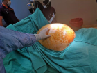 T�m�r al�n�nca 91 kilodan 70 kiloya d��t�