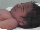 T�p bebek tedavisinde T�rkiye'ye yo�un hasta g��� var
